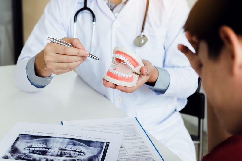 5 Things you need to know about Dentures