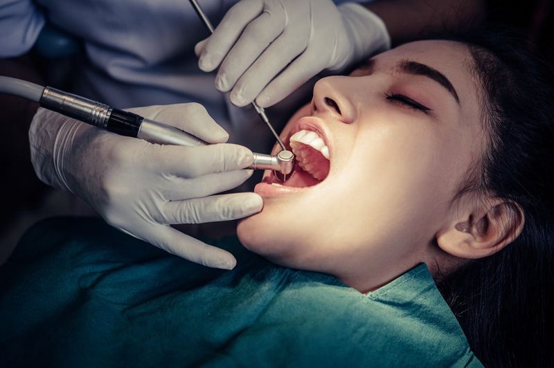 Everything You Need to Know About Dental Fillings - Types of Dental Fillings