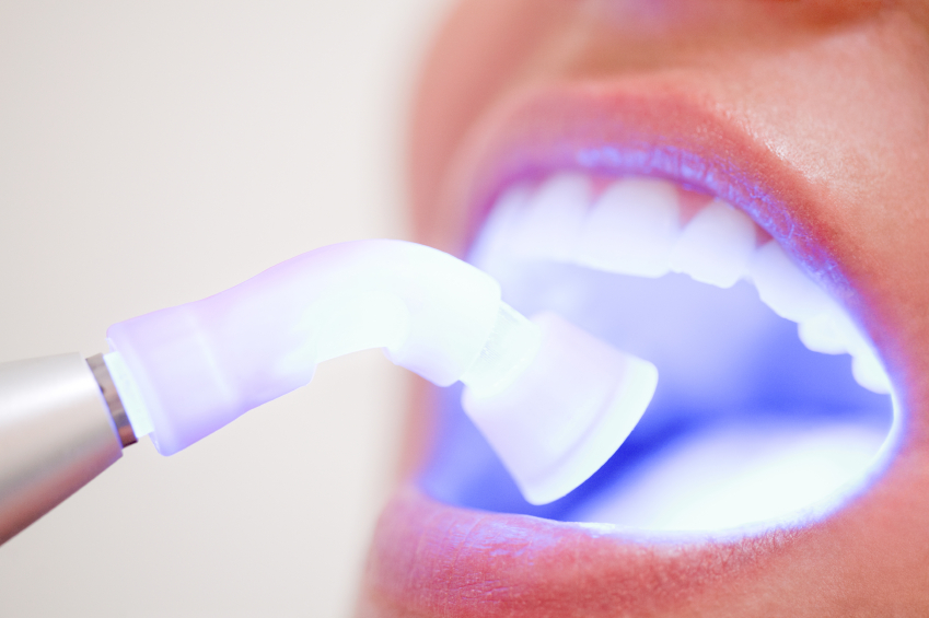 Dental Blog - Importance of Orthodontic Treatments