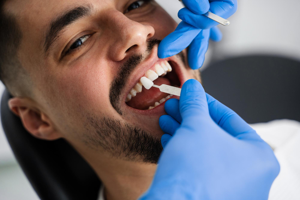 Professional Dental Crown and Bridge Treatment in San Jose