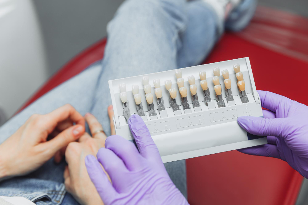 Pros and Cons of Veneer Teeth