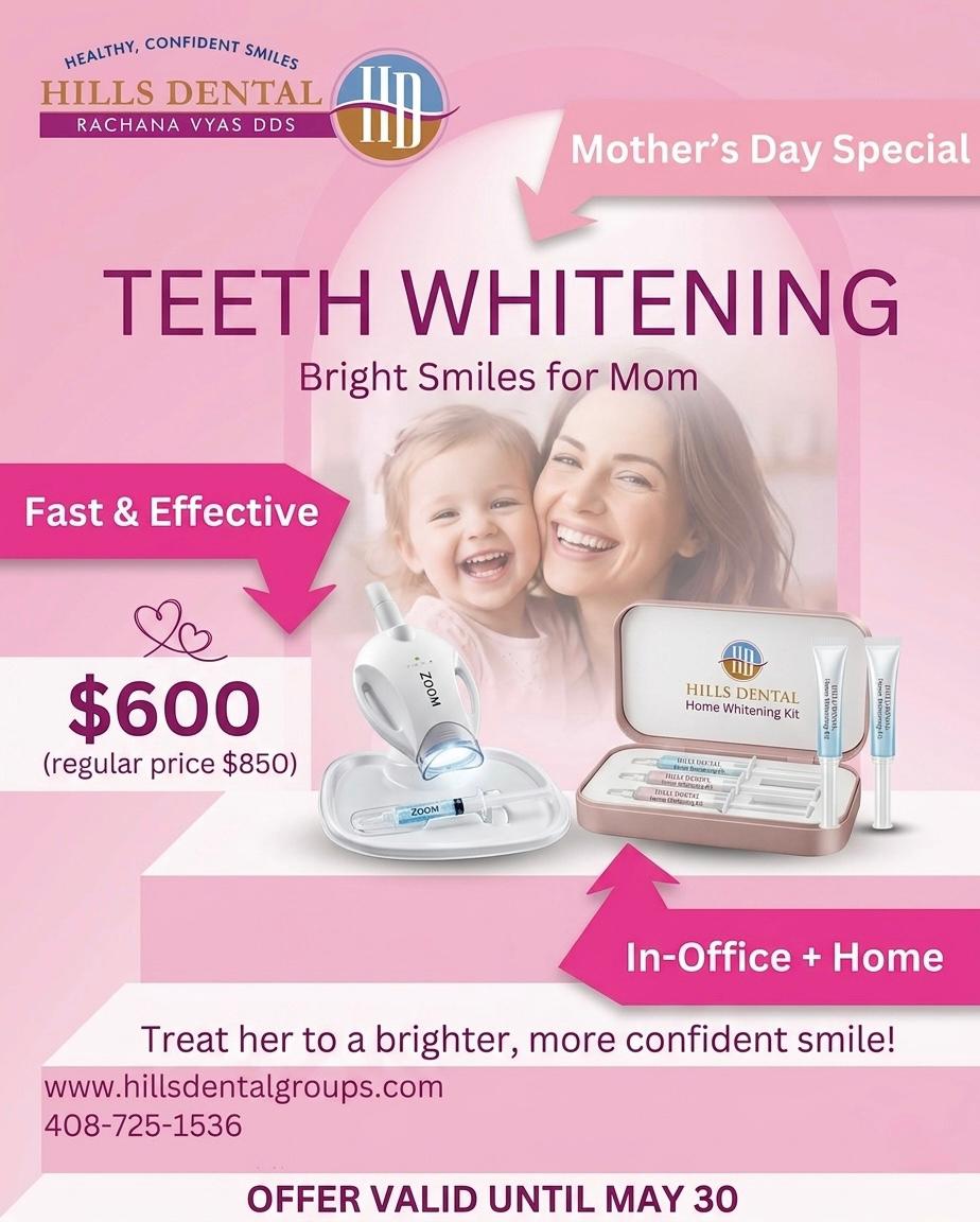 Teeth Whitening Treatment in San Jose