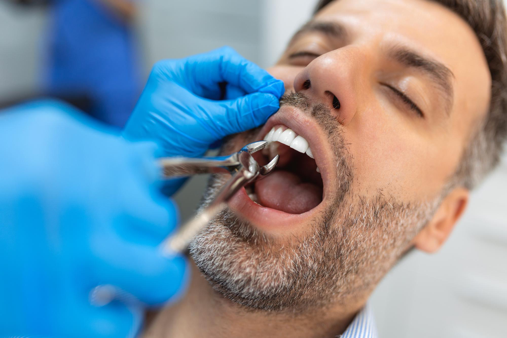 Tooth Extraction Procedure